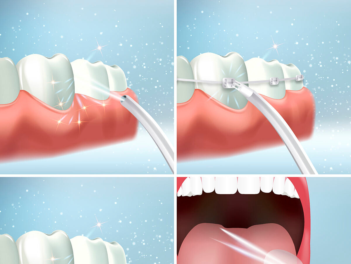 V13H3D40601A211EDA7B15FB2BF57E7F023ER5277317P5